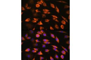 Immunofluorescence analysis of L929 cells using CYP51 Rabbit pAb (3485) at dilution of 100 (40x lens).