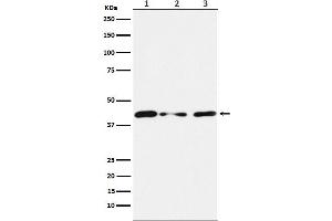 Western blot analysis of Tin2 expression in (1) HUVEC cell lysate, (2) NIH/3T3 cell lysate, (3) PC12 cell lysate.