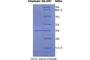 SDS-PAGE of Protein Standard from the Kit (Highly purified E. (GLDC Kit ELISA)