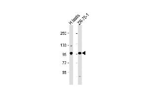 All lanes : Anti-STK31 Antibody (C-term) at 1:1000 dilution Lane 1: human testis lysate Lane 2: ZR-75-1 whole cell lysate Lysates/proteins at 20 μg per lane. (STK31 anticorps  (C-Term))