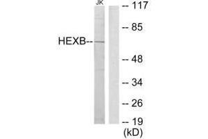 Western blot analysis of extracts from Jurkat cells, using HEXB antibody. (HEXB anticorps  (C-Term))
