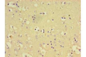 Immunohistochemistry of paraffin-embedded human brain tissue using ABIN7174112 at dilution of 1:100 (PTPN5 anticorps  (AA 300-555))