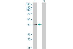 Western Blot analysis of ADH4 expression in transfected 293T cell line by ADH4 monoclonal antibody (M01), clone 3C5.