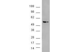 HEK293 overexpressing AKT3 (ABIN5421464) and probed with ABIN185314 (mock transfection in second lane). (AKT3 anticorps  (AA 119-133))