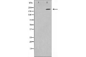 Western blot analysis on HuvEc cell lysate using Sodium Channel-pan Antibody,The lane on the left is treated with the antigen-specific peptide. (Sodium Channel-Pan anticorps)