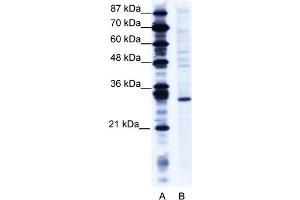 WB Suggested Anti-RNF141 Antibody   Titration: 1. (RNF141 anticorps  (Middle Region))