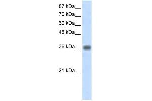 WB Suggested Anti-KLHDC8A Antibody Titration:  1. (KLHDC8A anticorps  (C-Term))