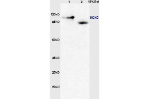 Lane 1: mouse brain lysates Lane 2: human colon carcinoma lysates probed with Anti GRM4/mGluR4 Polyclonal Antibody, Unconjugated (ABIN735998) at 1:200 in 4 °C. (GRM4/6 anticorps  (AA 301-400))