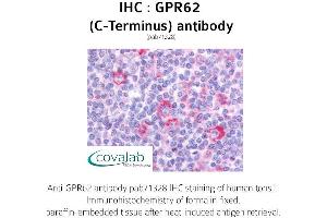 Image no. 1 for anti-G Protein-Coupled Receptor 62 (GPR62) (C-Term) antibody (ABIN1735137)