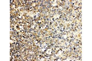 Anti-IL3 antibody, IHC(P) IHC(P): Human Tonsil Tissue