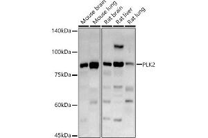 Western blot analysis of extracts of various cell lines, using PLK2 antibody (ABIN6132905, ABIN6145776, ABIN6145778 and ABIN6222860) at 1:1000 dilution. (PLK2 anticorps  (AA 322-671))