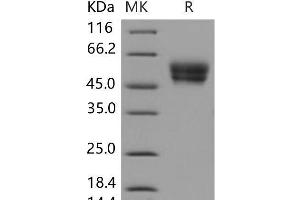 Western Blotting (WB) image for Cell Adhesion Molecule 4 (CADM4) protein (His tag) (ABIN7320253)