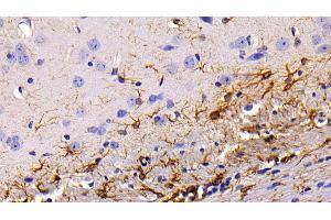 Detection of GFAP in Mouse Cerebrum Tissue using Polyclonal Antibody to Glial Fibrillary Acidic Protein (GFAP)