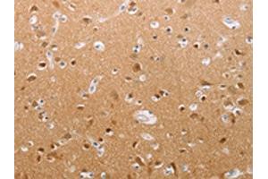 The image on the left is immunohistochemistry of paraffin-embedded Human brain tissue using ABIN7191852(PFN2 Antibody) at dilution 1/30, on the right is treated with synthetic peptide. (PFN2 anticorps)