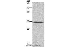 Western blot analysis of Human fetal liver tissue, using DDAH1 Polyclonal Antibody at dilution of 1:400 (DDAH1 anticorps)