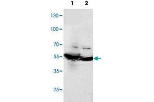 Western blot analysis of tissue lysates with DLD polyclonal antibody . (DLD anticorps  (C-Term))