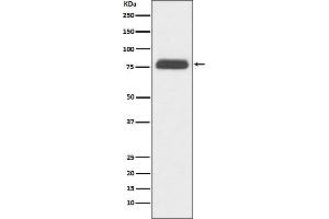 Western blot analysis of TBR1 expression in human fetal brain lysate.