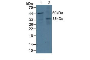 Western blot analysis of (1) Human Jurkat Cells and (2) Human A431 Cells. (DOK3 anticorps  (AA 128-385))