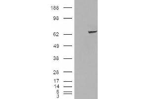 Western Blotting (WB) image for anti-Insulin-Like Growth Factor 2 mRNA Binding Protein 2 (IGF2BP2) antibody (ABIN5921444) (IGF2BP2 anticorps)