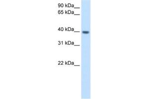 Western Blotting (WB) image for anti-Integrin beta 1 Binding Protein (Melusin) 2 (ITGB1BP2) antibody (ABIN2462574) (ITGB1BP2 anticorps)