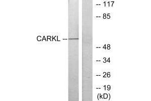 Western blot analysis of extracts from Jurkat cells, using CARKL antibody. (SHPK anticorps  (N-Term))