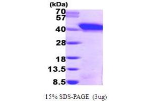 SDS-PAGE (SDS) image for Snurportin 1 (SNUPN) (AA 1-360) protein (His tag) (ABIN667159)