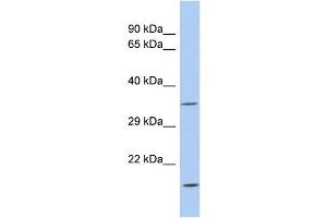 WB Suggested Anti-ASPDH Antibody Titration: 0. (ASPDH anticorps  (Middle Region))