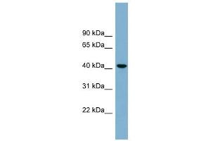 B4GALT2 antibody used at 1 ug/ml to detect target protein. (B4GALT2 anticorps  (Middle Region))