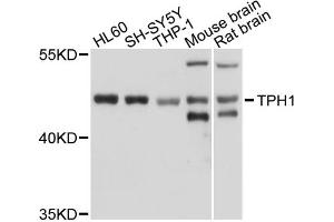 Western blot analysis of extracts of various cell lines, using TPH1 antibody (ABIN5970750) at 1/1000 dilution. (Tryptophan Hydroxylase 1 anticorps)