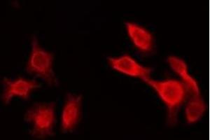 ABIN6275560 staining HepG2 by IF/ICC. (SHD anticorps  (Internal Region))