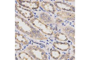 Immunohistochemistry (IHC) image for anti-3-phosphoinositide Dependent Protein Kinase-1 (PDPK1) (AA 150-429) antibody (ABIN3022352)