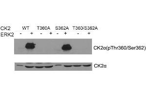 Western blot of CK2a(Phospho- Thr360/Ser362) antibody and CK2a antibody in vitro kinase assay. (CSNK2A1/CK II alpha anticorps  (pSer362, pThr360))