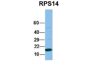 Host:  Rabbit  Target Name:  RPS14  Sample Type:  MCF7  Antibody Dilution:  1.