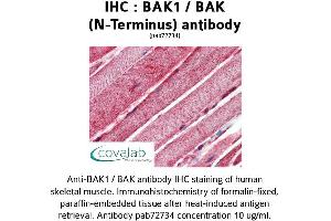 Image no. 2 for anti-BCL2-Antagonist/killer 1 (BAK1) (N-Term) antibody (ABIN1732215) (BAK1 anticorps  (N-Term))