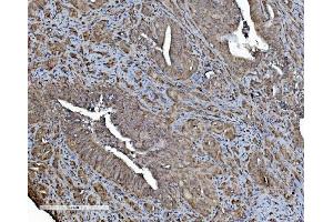 IHC analysis of REA/PHB2 using anti-REA/PHB2 antibody (ABIN7599239). (Prohibitin 2 anticorps  (AA 1-299))