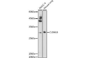 Western blot analysis of extracts of various cell lines, using CLDN18 antibody (ABIN6127701, ABIN6138681, ABIN6138682 and ABIN6224437) at 1:1000 dilution. (Claudin 18 anticorps  (AA 20-80))