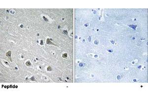 Immunohistochemistry analysis of paraffin-embedded human brain tissue using MYLIP polyclonal antibody . (MYLIP anticorps)