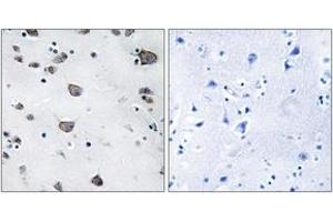 Immunohistochemistry (IHC) image for anti-Apoptosis-Inducing Factor, Mitochondrion-Associated, 3 (AIFM3) (AA 10-59) antibody (ABIN2889860) (AIFM3 anticorps  (AA 10-59))