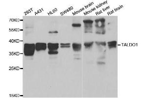 Western blot analysis of extracts of various cell lines, using TALDO1 antibody. (TALDO1 anticorps  (AA 1-337))