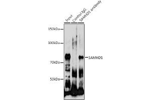 Immunoprecipitation analysis of 200 μg extracts of HeLa cells using 3 μg S antibody (ABIN6132834, ABIN6147368, ABIN6147369 and ABIN7101817).