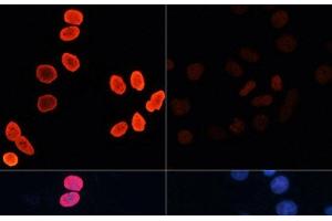 Immunofluorescence analysis of HeLa cells using Acetyl-Histone H2B-K15 Polyclonal Antibody at dilution of 1:100.