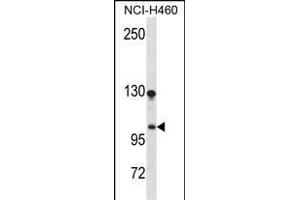 DLG Antibody (N-term) (ABIN1539122 and ABIN2850094) western blot analysis in NCI- cell line lysates (35 μg/lane). (DLGAP3 anticorps  (N-Term))