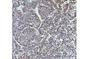 anti-ER Degradation Enhancer, Mannosidase alpha-Like 3 (EDEM3) (AA 54-795) antibody