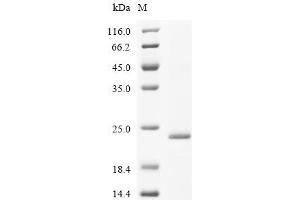 (Tris-Glycine gel) Discontinuous SDS-PAGE (reduced) with 5 % enrichment gel and 15 % separation gel.