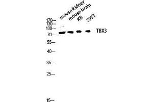 Western Blot (WB) analysis of Mouse Kidney Mouse Brain KB 293T lysis using TBX3 antibody. (TBX3 anticorps  (Internal Region))
