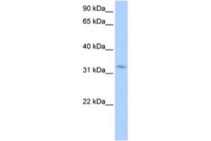 Western Blotting (WB) image for anti-Nuclear Receptor Interacting Protein 2 (NRIP2) antibody (ABIN2463362) (NRIP2 anticorps)