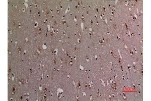 Immunohistochemistry (IHC) analysis of paraffin-embedded Human Brain, antibody was diluted at 1:100.