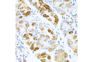 Immunohistochemistry of paraffin-embedded human stomach using BMP3 antibody (ABIN5975705) at dilution of 1/100 (40x lens). (BMP3 anticorps)