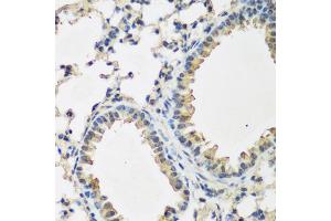 Immunohistochemistry of paraffin-embedded mouse lung using BMP2 antibody. (BMP2 anticorps)