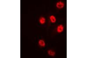 Immunofluorescent analysis of Histone Deacetylase 1 staining in HeLa cells. (HDAC1 anticorps  (C-Term))